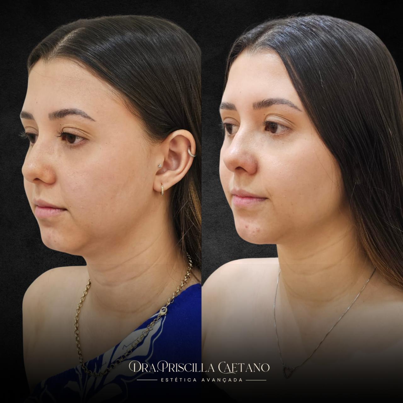 WhatsApp Image 2025-11-13 at 17.33.35